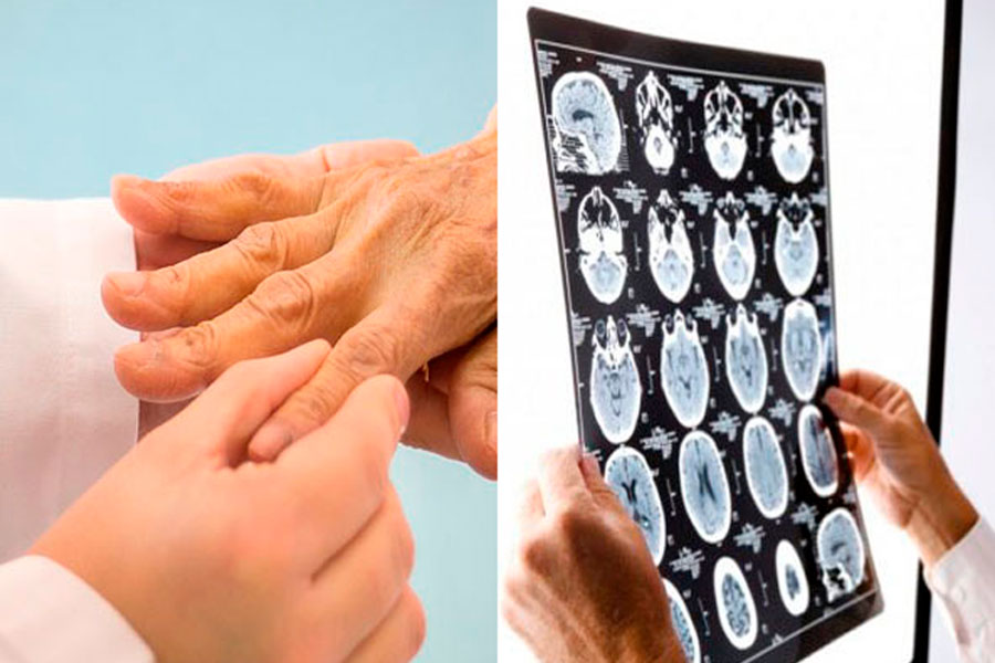 umabrains radiografía